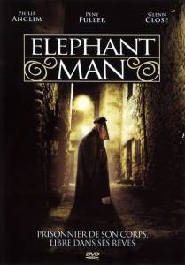 Человек-слон (ТВ) (1982)